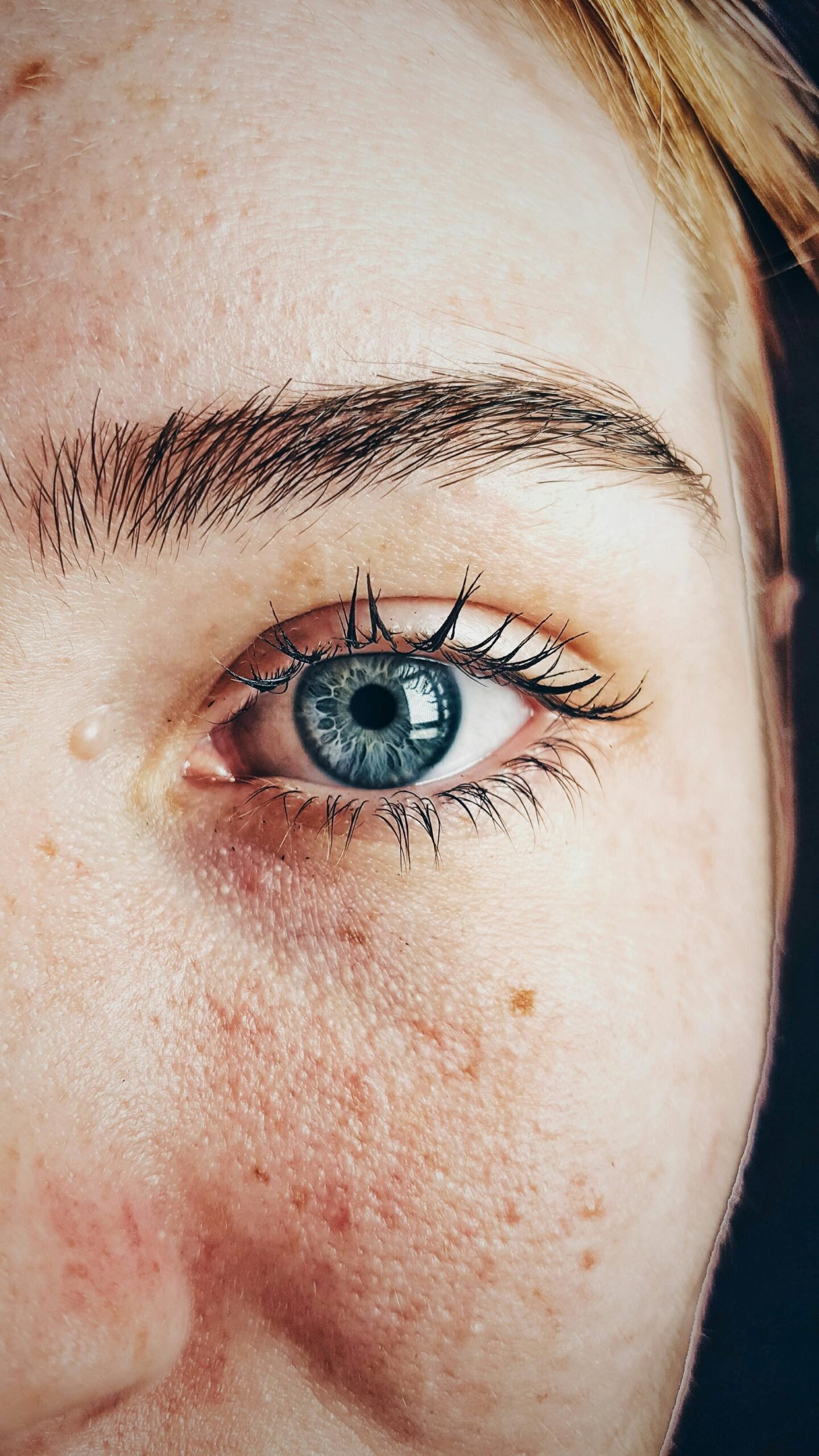 Do This 5 Second Ritual Daily and Skintags & Moles Just Start Falling Out - Unbelievable Results